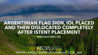 "Argentinian flag sign, IOL placed and then dislocated completely after IStent placement"